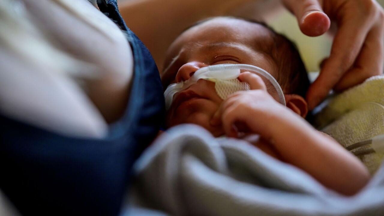 Los hospitales desbordados por ola de bronquiolitis infantil