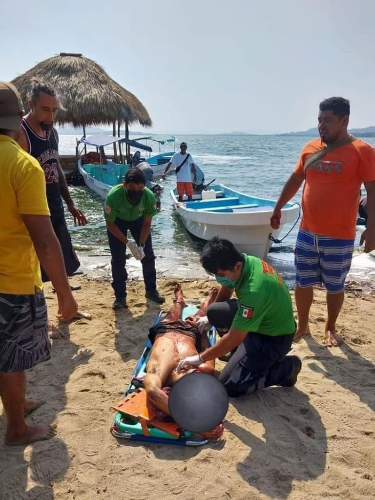 Atacan a tres turistas argentinos a machetazos