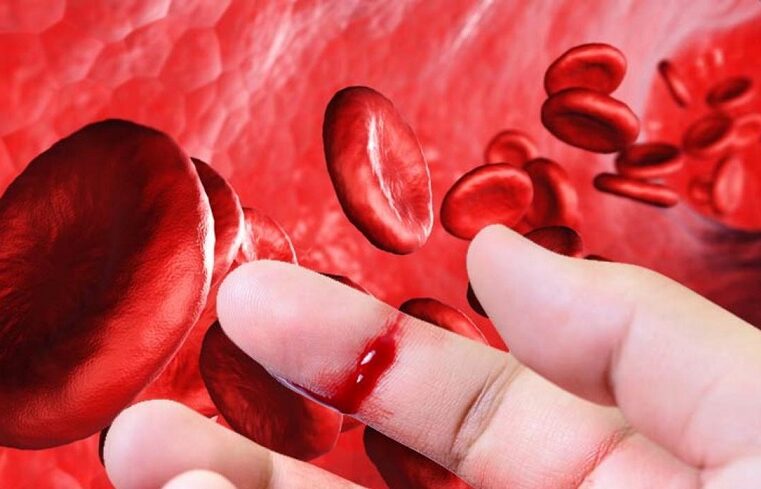 Pacientes con hemofilia B exigen abastecimiento urgente del Factor IX en Arequipa