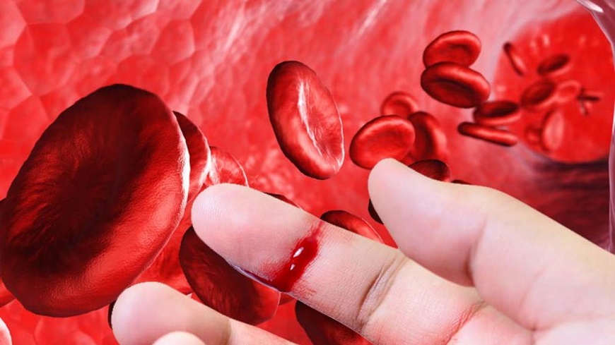 Pacientes con hemofilia B exigen abastecimiento urgente del Factor IX en Arequipa