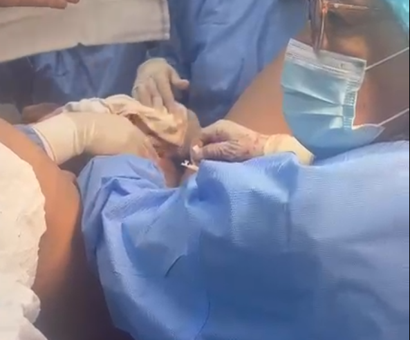 Otra madre y bebé fueron maltratados en sala de partos del hospital Goyeneche