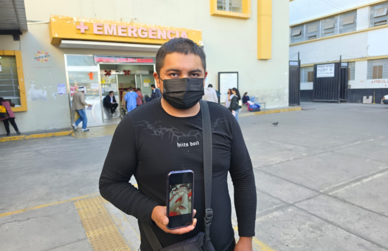 Niña herida en Camaná espera cirugía por falta de clavos.