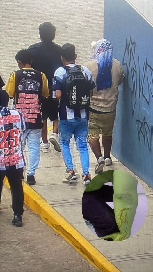Violencia entre hinchas deja a joven herido tras ataque en Hunter